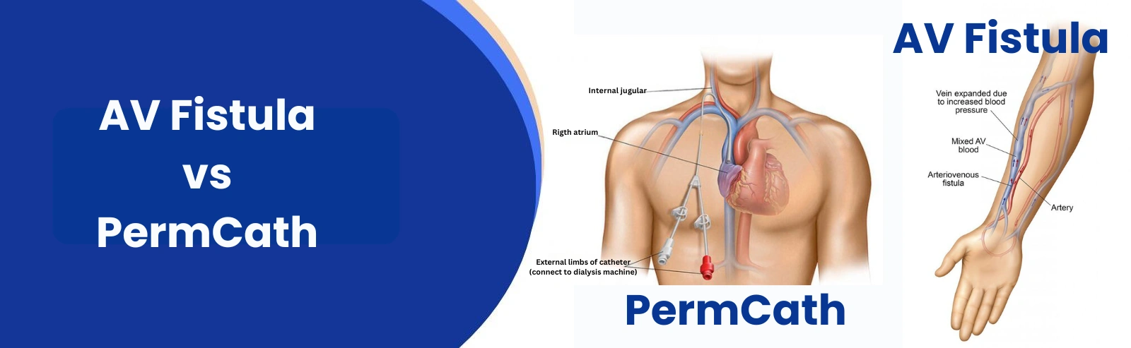 vascular_malformation_title_image_one_stop_vascular_solutions